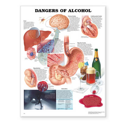 Dangers of Alcohol Anatomical Chart - 
