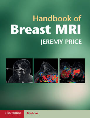 Handbook of Breast MRI - Jeremy Price