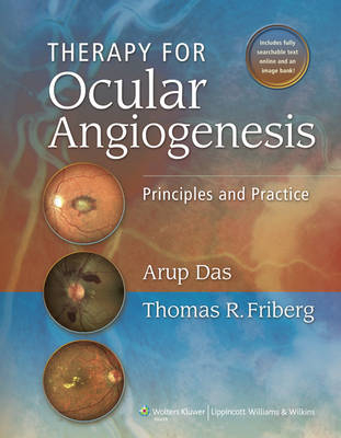 Therapy for Ocular Angiogenesis: Principles and Practice - Arup Das, Thomas Friberg