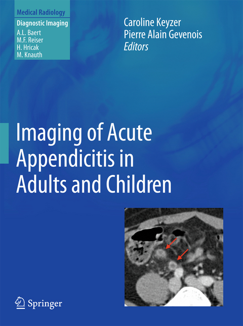 Imaging of Acute Appendicitis in Adults and Children - 