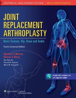 Joint Replacement Arthroplasty - 