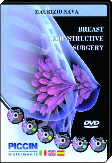 Breast Reconstructive Surgery - Maurizio Nava