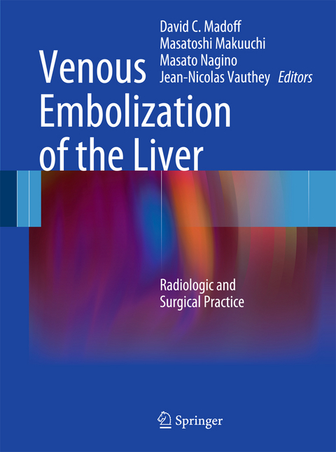 Venous Embolization of the Liver - 