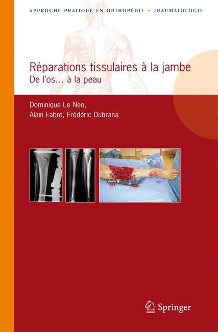 Reparations Tissulaires a la Jambe - Dominique Le Nen, Alain Fabre, Frederic Dubrana
