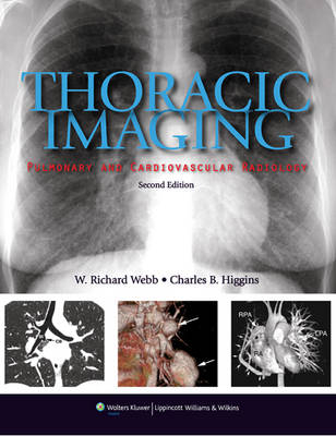 Thoracic Imaging - W. Richard Webb, Charles B. Higgins