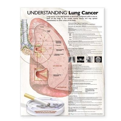 Understanding Lung Cancer Anatomical Chart