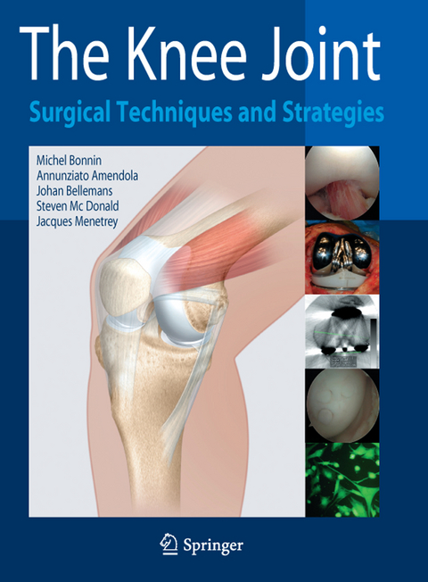 The Knee Joint - 