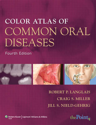 Color Atlas of Common Oral Diseases - Robert P. Langlais, Craig S. Miller, Jill S. Nield-Gehrig