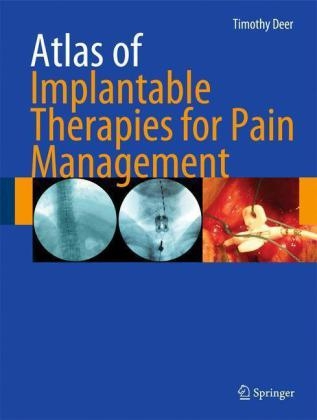 Atlas of Implantable Therapies for Pain Management - Timothy R. Deer