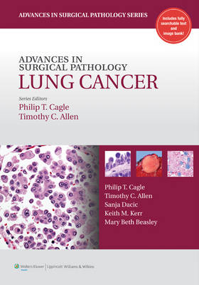Advances in Surgical Pathology: Lung Cancer - 