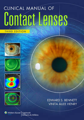Clinical Manual of Contact Lenses - 