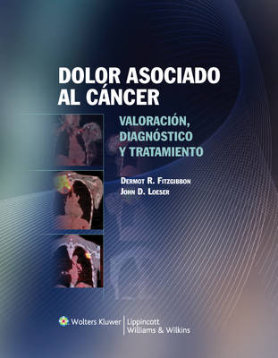 Dolor asociado al cáncer - Dermot R. Fitzgibbon, John D. Loeser