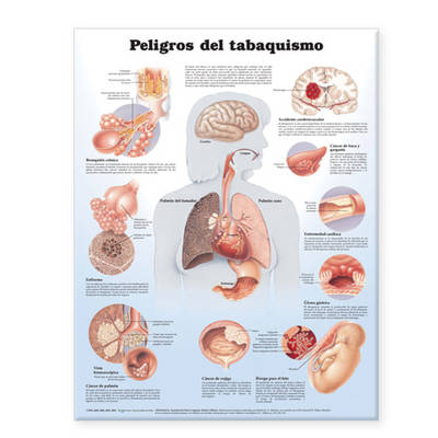 Dangers of Smoking Anatomical Chart in Spanish (Peligros del tabaquismo)