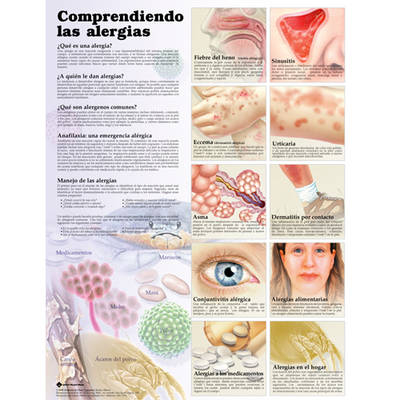 Understanding Allergies Anatomical Chart in Spanish (Entendiendo Las Alergias)