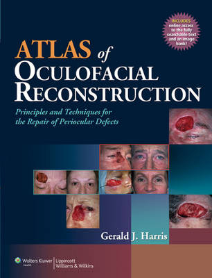 Atlas of Oculofacial Reconstruction - Gerald J. Harris