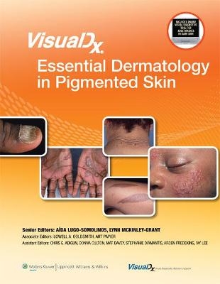 VisualDx: Essential Dermatology in Pigmented Skin - 