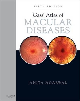 Gass' Atlas of Macular Diseases - Anita Agarwal