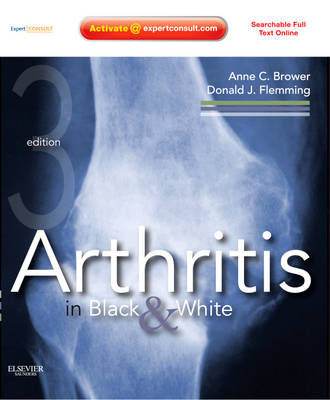 Arthritis in Black and White - Anne C. Brower, Donald J. Flemming