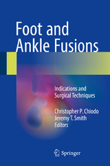Foot and Ankle Fusions - 