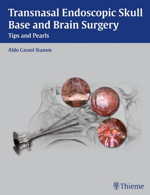 Transnasal Endoscopic Skull Base and Brain Surgery - 