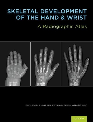 Skeletal Development of the Hand and Wrist - Cree M. Gaskin, S. Lowell Kahn, J. Christoper Bertozzi, Paul M. Bunch