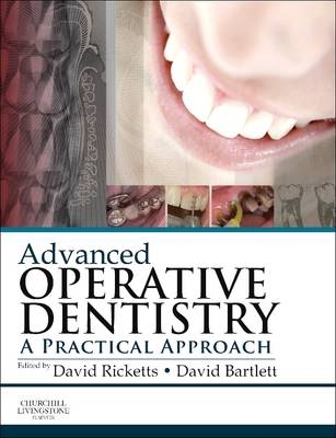 Advanced Operative Dentistry - 