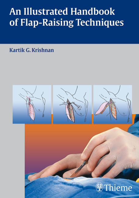 An Illustrated Handbook of Flap-Raising Techniques - Kartik Krishnan