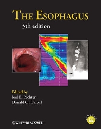 The Esophagus - 