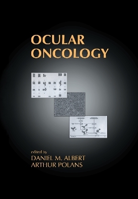 Ocular Oncology - 