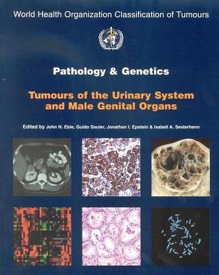 Pathology and Genetics of Tumours of the Urinary System and Male Genital Organs - 