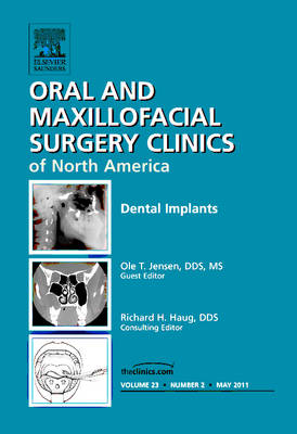 Dental Implants, An Issue of Oral and Maxillofacial Surgery Clinics - Ole Jensen