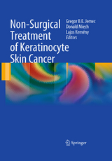Non-Surgical Treatment of Keratinocyte Skin Cancer - 