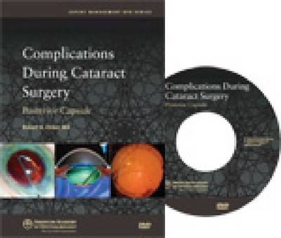 Challenging Cases in Cataract Surgery