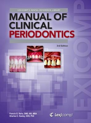 Manual of Clinical Periodontics - Francis G. Serio, Charles. E. Hawley