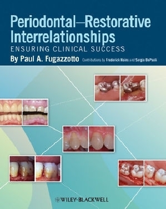 Periodontal-Restorative Interrelationships - Paul A. Fugazzotto