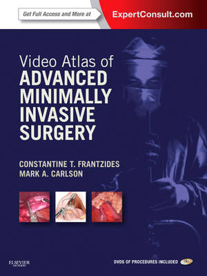 Video Atlas of Advanced Minimally Invasive Surgery E-Book - Constantine T Frantzides, Mark A Carlson