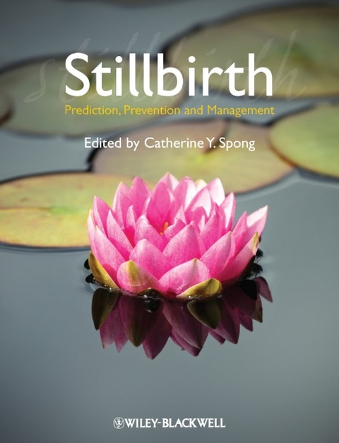 Stillbirth - 