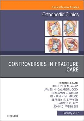 Controversies in Fracture Care, An Issue of Orthopedic Clinics - Frederick M. Azar, James H. Calandruccio, Benjamin J. Grear, Benjamin M. Mauck, Jeffrey R. Sawyer