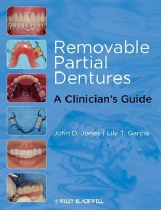 Removable Partial Dentures - John D. Jones, Lily T. García