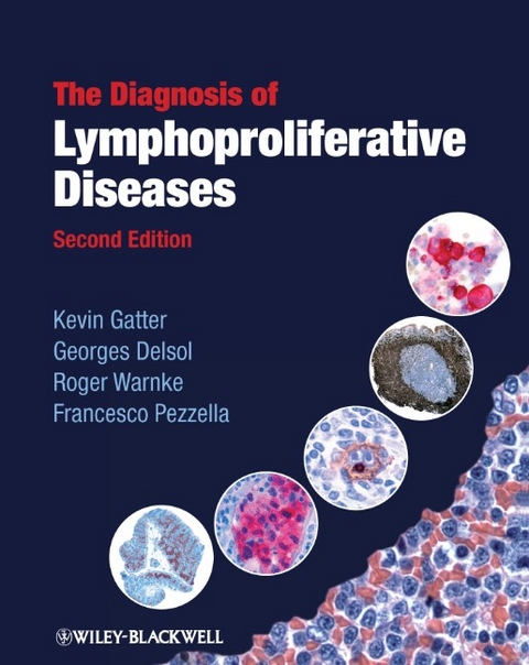 The Diagnosis of Lymphoproliferative Diseases - Kevin Gatter, Georges Delsol, Roger Warnke, Francesco Pezzella