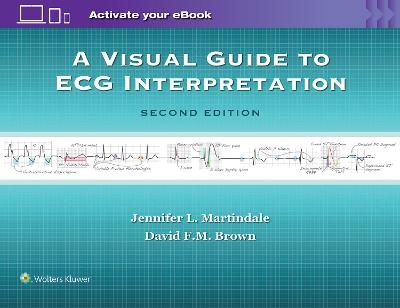 A Visual Guide to ECG Interpretation - Jennifer L Martindale, David F.M. Brown
