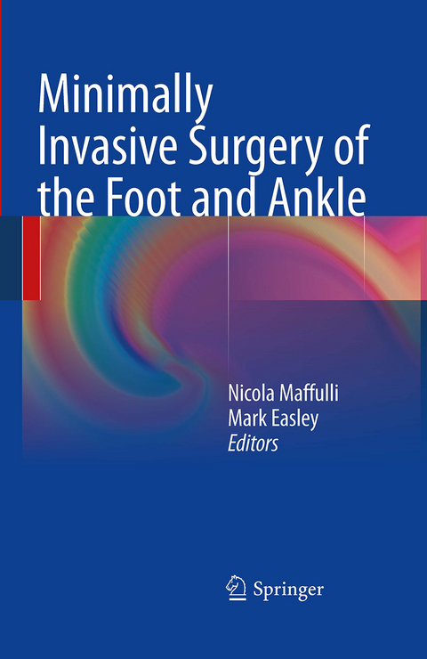 Minimally Invasive Surgery of the Foot and Ankle - 