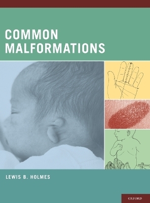 Common Malformations - Lewis B. Holmes