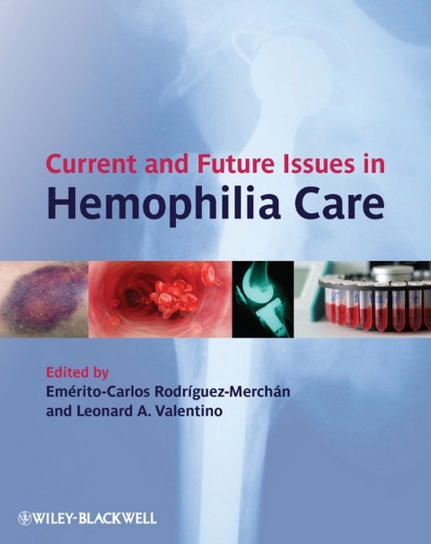 Current and Future Issues in Hemophilia Care - 