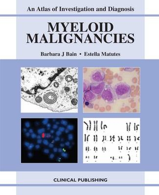 Myeloid Malignancies - 