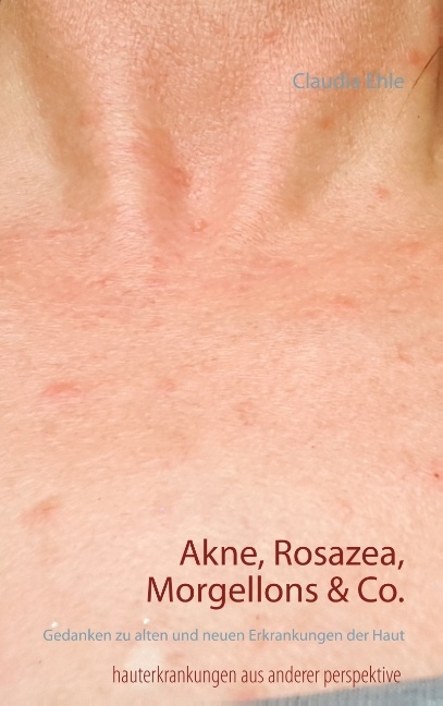 Akne, Rosazea, Morgellons & Co.