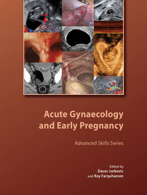 Acute Gynaecology and Early Pregnancy - 