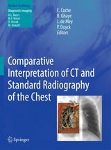 Comparative Interpretation of CT and Standard Radiography of the Chest - 