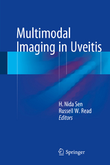 Multimodal Imaging in Uveitis - 