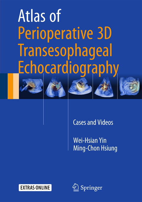 Atlas of Perioperative 3D Transesophageal Echocardiography - Wei-Hsian Yin, Ming-Chon Hsiung
